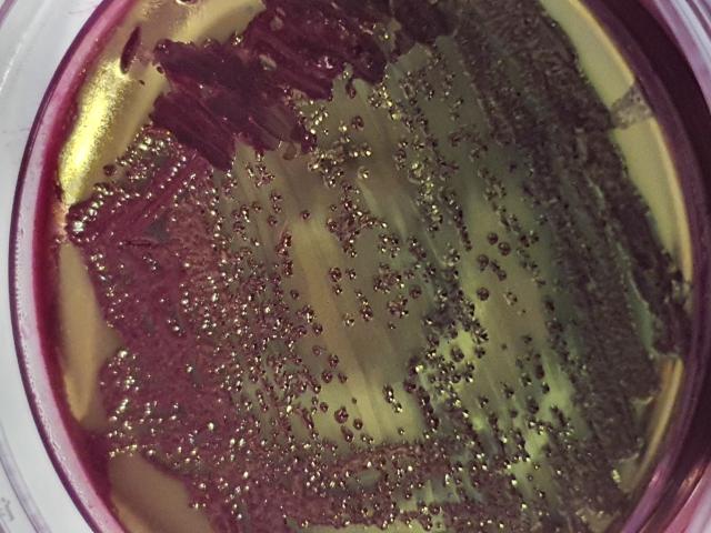 E.coli koloni dyrket på Endo-agar